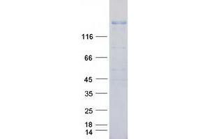 Western Blotting (WB) image for Receptor Tyrosine-Protein Kinase ErbB-3 (ERBB3) (Transcript Variant 1) protein (Myc-DYKDDDDK Tag) (ABIN2720372)