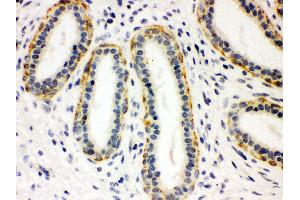 Immunohistochemistry (IHC) image for anti-Solute Carrier Family 6 (Neurotransmitter Transporter, serotonin), Member 4 (SLC6A4) (AA 57-85), (N-Term) antibody (ABIN3043931)