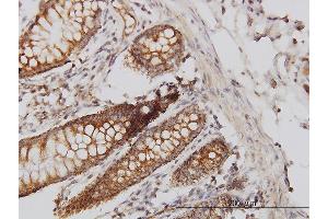 Immunoperoxidase of monoclonal antibody to HIP1 on formalin-fixed paraffin-embedded human colon. (HIP1 抗体  (AA 928-1037))