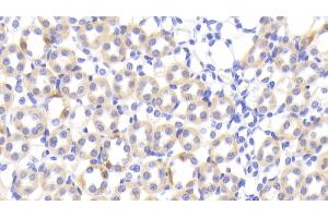 Detection of FABP1 in Rat Kidney Tissue using Polyclonal Antibody to Fatty Acid Binding Protein 1 (FABP1) (FABP1 抗体  (AA 1-127))