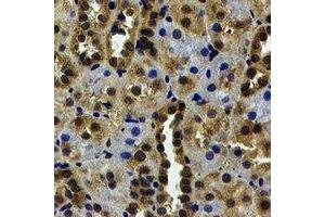 Immunohistochemical analysis of USP7 staining in human kidney formalin fixed paraffin embedded tissue section. (USP7 抗体)