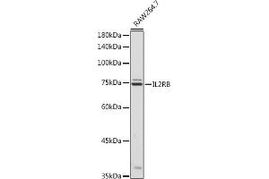 Western blot analysis of extracts of R. (IL2 Receptor beta 抗体  (AA 27-240))