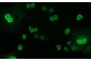 Anti-TP53 mouse monoclonal antibody (ABIN2454550) immunofluorescent staining of COS7 cells transiently transfected by pCMV6-ENTRY TP53 (RC200003). (p53 抗体)