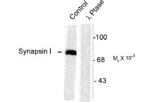 Western Blotting (WB) image for anti-Synapsin I (SYN1) (pSer603) antibody (ABIN361493)