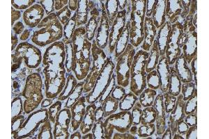 ABIN6279484 at 1/100 staining Rat kidney tissue by IHC-P. (HLA-DMA 抗体)