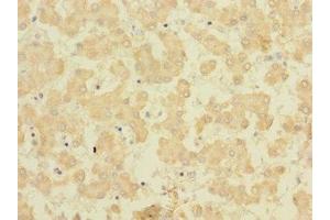 Immunohistochemistry of paraffin-embedded human liver tissue using ABIN7165454 at dilution of 1:100 (FAM187B 抗体  (AA 18-335))