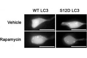 SH-SY5Y cells expressing GFP-LC3-WT or-S12D mutation (reduced puncta) treated with rapamycin or vehicle for 1h and probed with phospho-LC3C antibody (LC3C 抗体  (pSer12))