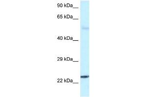 WB Suggested Anti-RAB31 Antibody Titration: 1. (RAB31 抗体  (C-Term))