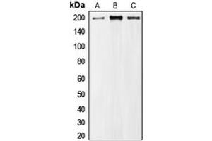 Western blot analysis of MRCK alpha expression in A549 (A), HeLa (B), NIH3T3 (C) whole cell lysates. (CDC42BPA 抗体  (Center))
