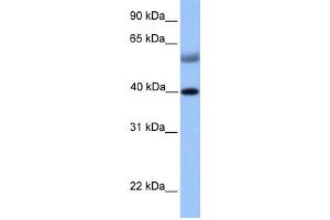 WB Suggested Anti-ISL1 Antibody Titration:  0. (ISL1 抗体  (N-Term))