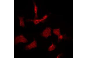 ABIN6267009 staining K562 by IF/ICC. (AKT1/3 抗体)