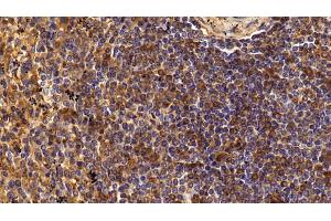 Detection of CD4 in Human Spleen Tissue using Polyclonal Antibody to Cluster Of Differentiation 4 (CD4) (CD4 抗体  (AA 27-394))