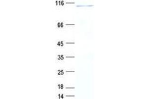 Western Blotting (WB) image for UTP14, U3 Small Nucleolar Ribonucleoprotein, Homolog A (UTP14A) protein (DYKDDDDK Tag) (ABIN2735152)