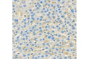 Immunohistochemistry (Paraffin-embedded Sections) (IHC (p)) image for anti-threonine Synthase-Like 2 (THNSL2) antibody (ABIN7075893)