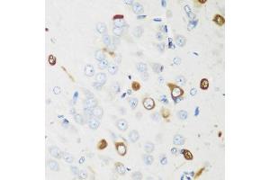 Immunohistochemistry of paraffin-embedded rat brain using EL antibody (ABIN6134649, ABIN6140114, ABIN6140116 and ABIN6221621) at dilution of 1:200 (40x lens).