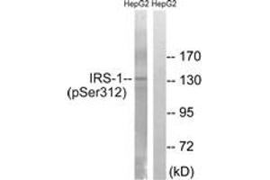 Western blot analysis of extracts from HepG2 cells, using IRS-1 (Phospho-Ser312) Antibody. (IRS1 抗体  (pSer312))