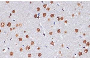 Immunohistochemistry of paraffin-embedded Rat brain using PELP1 Polyclonal Antibody at dilution of 1:100 (40x lens). (PELP1 抗体)