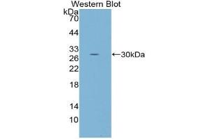 Western blot analysis of the recombinant protein. (FOS 抗体  (AA 55-298))