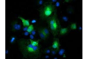 Anti-MAPRE2 mouse monoclonal antibody (ABIN2454584) immunofluorescent staining of COS7 cells transiently transfected by pCMV6-ENTRY MAPRE2 (RC200259). (MAPRE2 抗体)