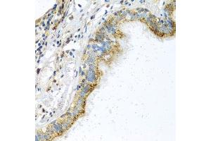Immunohistochemistry of paraffin-embedded human trachea using ATPIF1 antibody. (ATPase Inhibitory Factor 1 抗体  (AA 26-106))
