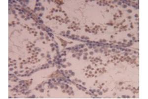 Immunohistochemistry (IHC) image for anti-Carboxypeptidase B2 (Plasma) (CPB2) (AA 187-327) antibody (ABIN7438001)