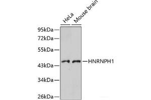 Western blot analysis of extracts of various cell lines using HNRNPH1 Polyclonal Antibody.