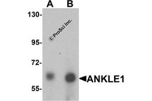 Western Blotting (WB) image for anti-Ankyrin Repeat and LEM Domain Containing 1 (ANKLE1) (C-Term) antibody (ABIN1030236) (ANKLE1 抗体  (C-Term))
