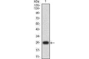 Western blot analysis using CCNE1 mAb against human CCNE1 (AA: 1-100) recombinant protein.