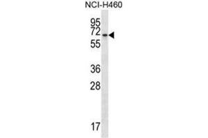 BEND4 Antibody (N-term) western blot analysis in NCI-H460 cell line lysates (35µg/lane). (BEND4 抗体  (N-Term))