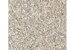 IHC analysis of DDIT3 using anti-DDIT3 antibody (ABIN7599026). (DDIT3 抗体  (AA 1-169))