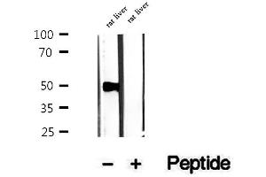Western blot analysis of extracts of rat liver tissue, using PMPCB antibody. (PMPCB 抗体  (Internal Region))