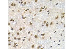 Immunohistochemistry of paraffin-embedded Rat brain using LBR Polyclonal Antibody at dilution of 1:200 (40x lens). (Lamin B Receptor 抗体)