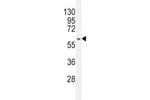 Anti-MDM2 antibody western blot analysis in HepG2 lysate (MDM2 抗体  (AA 393-424))