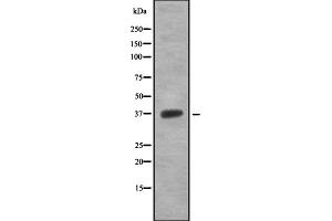 Western blot analysis OR5T1 using 293 whole cell lysates (OR5T1 抗体)