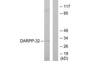 Western blot analysis of extracts from 293 cells treated with EGF (200 ng/mL, 30 min), using DARPP-32 (Ab-75) antibody. (DARPP32 抗体  (Thr75))