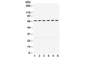 Western blot testing of human 1) HeLa, 2) 22RV1, 3) HepG2, 4) SKOV, 5) A431 and 6) HT1080 cell lysate with ERV3 antibody.