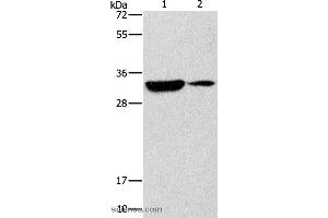 Western blot analysis of Mouse heart and brain tissue, using RCAN1 Polyclonal Antibody at dilution of 1:500 (RCAN1 抗体)