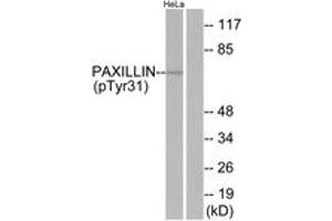 Western blot analysis of extracts from HeLa cells treated with TNF 200ng/ml 2', using Paxillin (Phospho-Tyr31) Antibody. (Paxillin 抗体  (pTyr31))