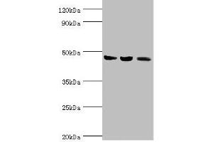 Western blot All lanes: ACAT1 antibody at 6 μg/mL Lane 1: Mouse skeletal musce tissue Lane 2: Rat heart tissue Lane 3: THP-1 whole cell lysate Secondary Goat polyclonal to rabbit IgG at 1/10000 dilution Predicted band size: 46, 18 kDa Observed band size: 46 kDa (ACAT1 抗体  (AA 1-145))