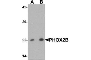 Western blot analysis of PHOX2B in 293 cell lysate with PHOX2B Antibody  at (A) 1 and (B) 2 ug/mL. (PHOX2B 抗体  (Middle Region))