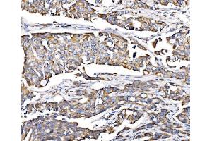 IHC analysis of PMPCA/INPP5 using anti-PMPCA/INPP5 antibody (ABIN7602722). (PMPCA 抗体  (AA 99-525))