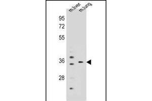 KCNRG Antibody (C-term) (ABIN655796 and ABIN2850485) western blot analysis in mouse liver,lung tissue lysates (35 μg/lane).