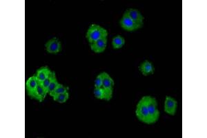 Immunofluorescence staining of HepG2 cells with ABIN7172883 at 1:100, counter-stained with DAPI. (TRPV3 抗体  (AA 1-118))