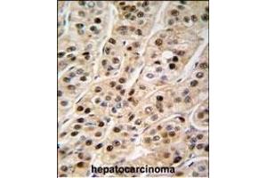 Immunohistochemistry (Paraffin-embedded Sections) (IHC (p)) image for anti-Proliferating Cell Nuclear Antigen (PCNA) (AA 231-261), (C-Term) antibody (ABIN389344)
