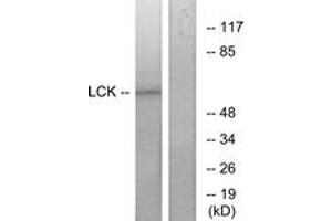 Western blot analysis of extracts from 293 cells, treated with serum 15% 10', using Lck (Ab-393) Antibody. (LCK 抗体  (AA 361-410))