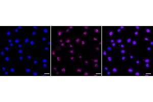 Immunocytochemical staining of C2C12 cells with Lysine demethylase 4A antibody (ABIN7799301), 1:1,000). (Recombinant KDM4A 抗体)