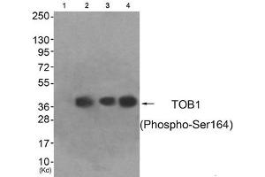 Western blot analysis of extracts from HeLa cells (Lane 2), A549 cells (Lane 3) and HepG2 cells (Lane 4), using TOB1 (Phospho-Ser164) Antibody. (Protein Tob1 (TOB1) (pSer164) 抗体)