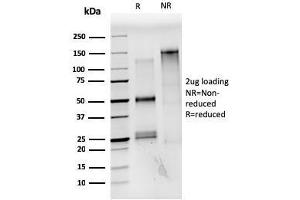 SDS-PAGE Analysis Purified Estrogen Receptor alpha Mouse Monoclonal Antibody (ESR1/3559). (Estrogen Receptor alpha 抗体  (AA 129-312))