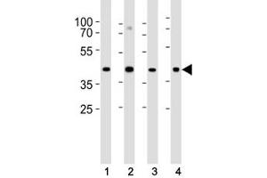 Western Blotting (WB) image for anti-Gap Junction Protein, alpha 1, 43kDa (GJA1) (AA 107-138) antibody (ABIN3031020)