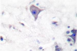 Image no. 2 for anti-Claudin 5 (CLDN5) antibody (ABIN265364) (Claudin 5 抗体)
